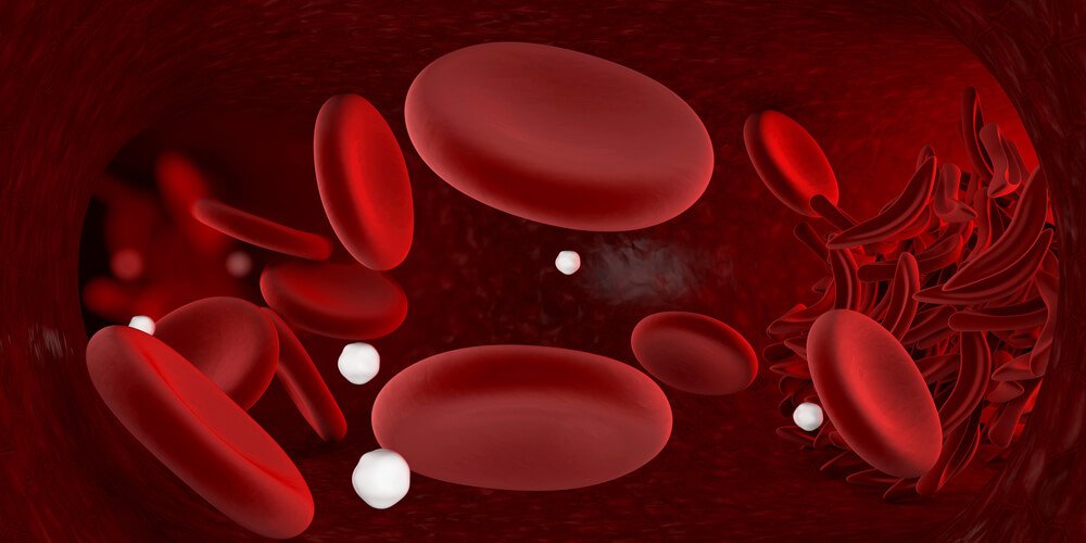 علم الوراثة وفقر الدم المنجلي