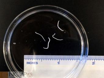 الدودة الشصية