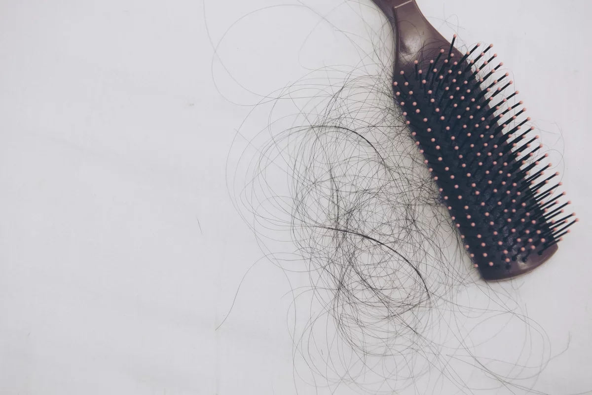 8 أسباب رئيسية لتساقط الشعر (وماذا تفعل)