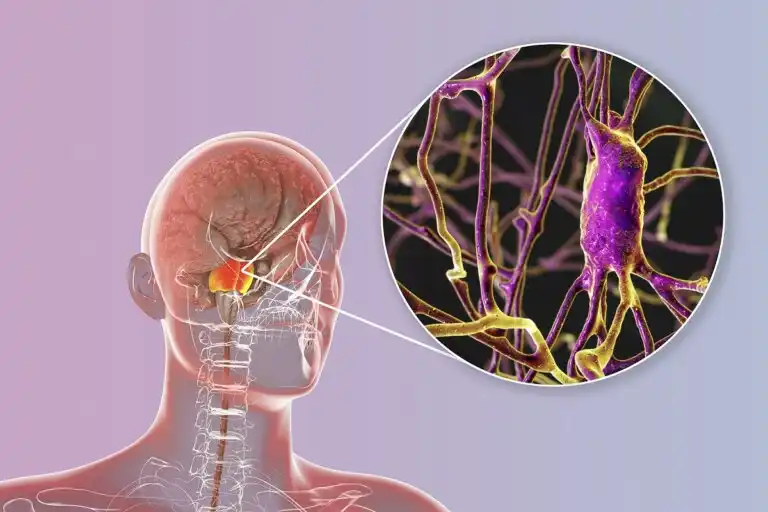 سرطان الغدد الليمفاوية في الجهاز العصبي المركزي: ماذا يجب أن تعرف؟