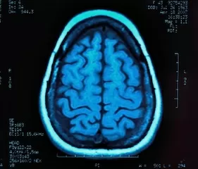 هل يستطيع التصوير بالرنين المغناطيسي الكشف عن التوحد؟