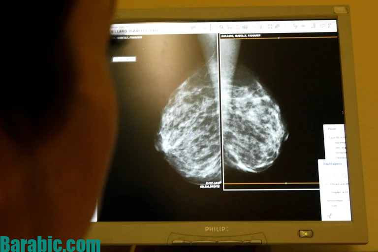 كيف تعمل إزالة الأورام غير الغازية التي طورها علماء إسرائيليون