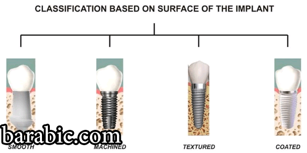 التصنيف على أساس سطح الغرسة