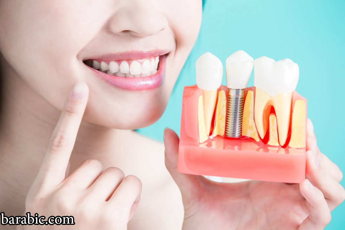 أفضل 8 خيارات لاستبدال الأسنان المفقودة