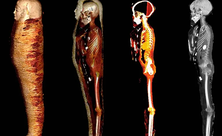 كشف ماسح ضوئي رقمي أسرار مومياء عمرها 2300 عام