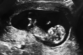 تنمية الطفل - 12 أسبوعا من الحمل