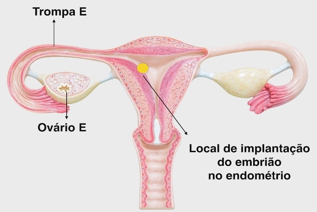 كيفية علاج بطانة الرحم رقيقة للحصول على الحوامل